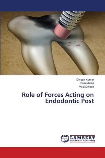 Role of Forces Acting on Endodontic Post Kumar Dinesh