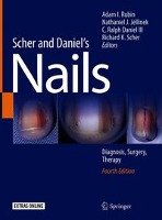 Scher and Daniel's Nails Springer-Verlag Gmbh, Springer International Publishing