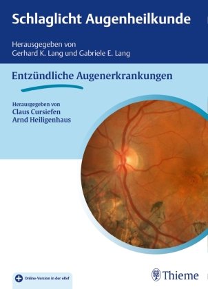 Schlaglicht  Augenheilkunde: Entzündliche Erkrankungen Thieme Georg Verlag, Thieme