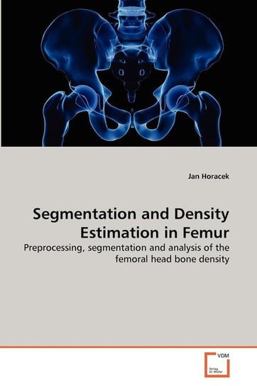 Segmentation and Density Estimation in Femur Horacek Jan