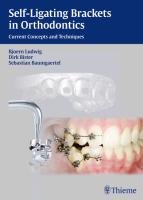 Self-ligating Brackets in Orthodontics Ludwig Bjorn, Bister Dirk, Baumgartel Sebastian