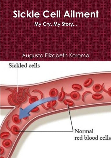 Sickle Cell Augusta Elizabeth Koroma