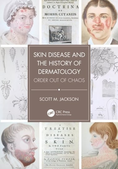 Skin Disease and the History of Dermatology: Order out of Chaos Opracowanie zbiorowe
