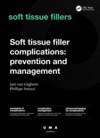 Soft Tissue Filler Complications: Prevention and Management Opracowanie zbiorowe