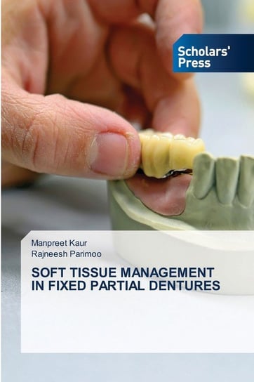 Soft Tissue Management In Fixed Partial Dentures Kaur Manpreet