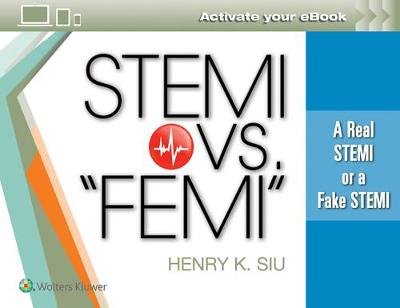 Stemi vs. "femi": A Real Stemi or a Fake Stemi Siu Henry K.