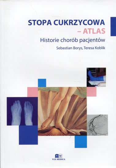 Stopa cukrzycowa. Atlas. Historie chorób pacjentów Borys Sebastian, Koblik Teresa