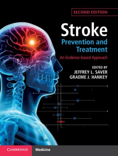 Stroke Prevention and Treatment. An Evidence-based Approach Opracowanie zbiorowe