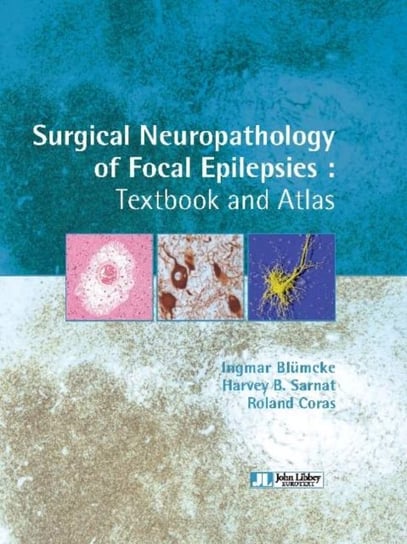 Surgical Neuropathology of Focal Epilepsies Blumcke Ingmar, Sarnat Harvey B., Coras Roland