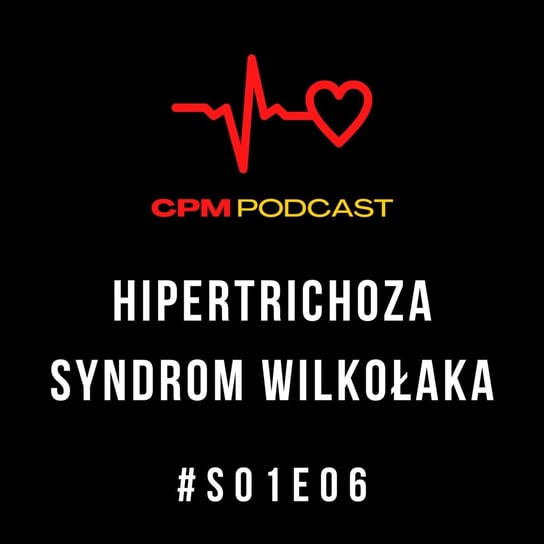 Syndrom wilkołaka | S01E06 | Ciekawe przypadki medyczne - Ciekawe przypadki medyczne - podcast - audiobook Zieliński Kamil