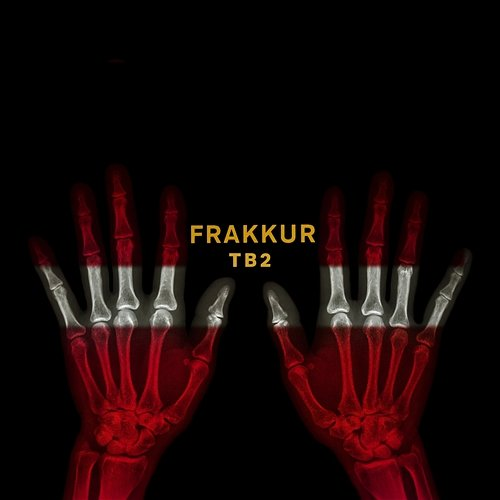 TB2 Frakkur