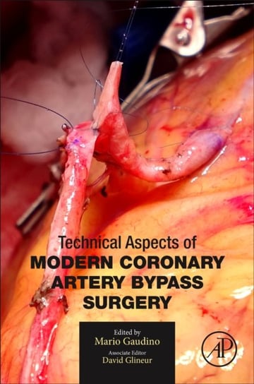 Technical Aspects of Modern Coronary Artery Bypass Surgery Opracowanie zbiorowe