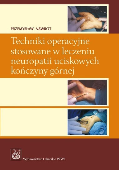 Techniki operacyjne stosowane w leczeniu neuropatii uciskowych kończyny górnej Nawrot Przemysław