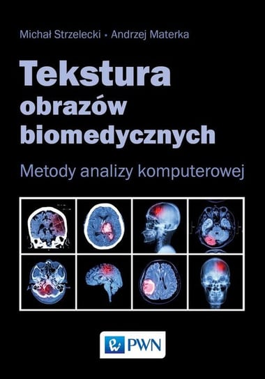 Tekstura obrazów biomedycznych. Metody analizy komputerowej Strzelecki Michał, Materka Andrzej