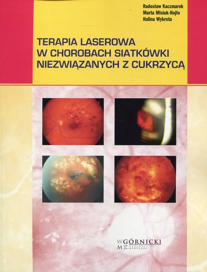 Terapia laserowa w chorobach siatkówki niezwiązanych z cukrzycą Kaczmarek Radosław, Misiuk-Hojło Marta, Wykrota Halina