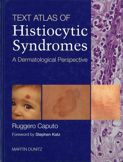 Text Atlas of Histiocytic Syndromes Caputo Ruggero