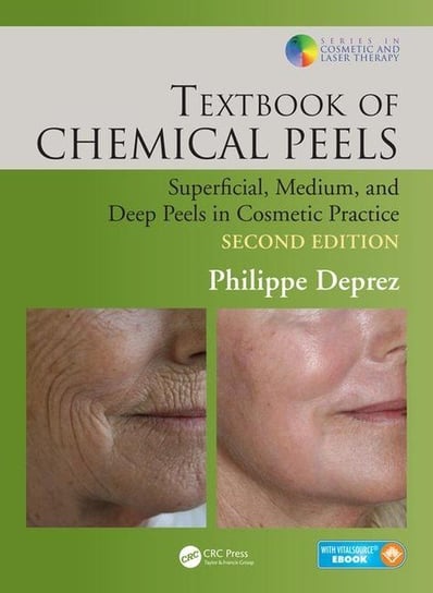 Textbook of Chemical Peels Deprez Philippe
