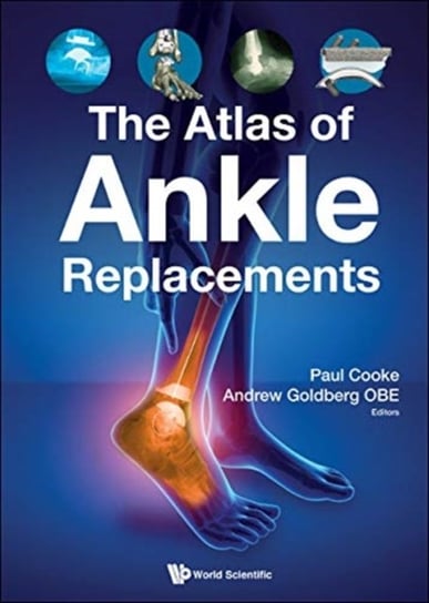 The Atlas of Ankle Replacements World Scientific Pub Co Inc.