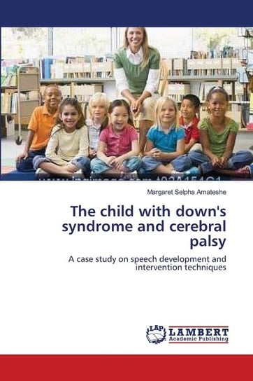 The child with down's syndrome and cerebral palsy Selpha Amateshe Margaret
