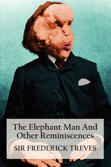 The Elephant Man and Other Reminiscences Treves Frederick