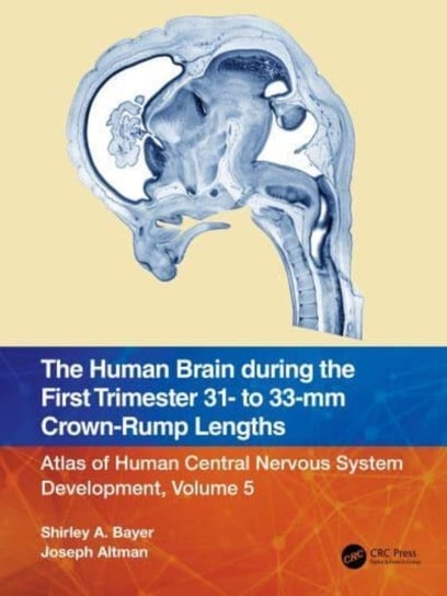 The Human Brain during the First Trimester 31- to 33-mm Crown-Rump Lengths: Atlas of Human Central Nervous System Development, Volume 5 Opracowanie zbiorowe
