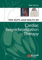 The Nuts and Bolts of Cardiac Resynchronization Therapy Kenny Tom