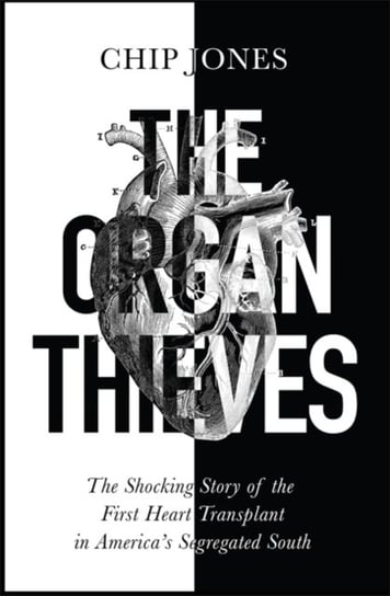 The Organ Thieves Chip Jones