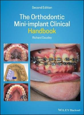 The Orthodontic Mini-implant Clinical Handbook Opracowanie zbiorowe