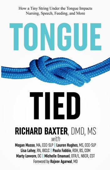 Tongue-Tied Baxter Dmd Ms
