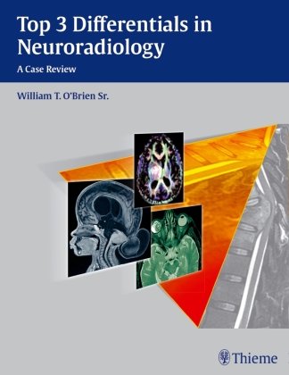 Top 3 Differentials in Neuroradiology O'brien William T.