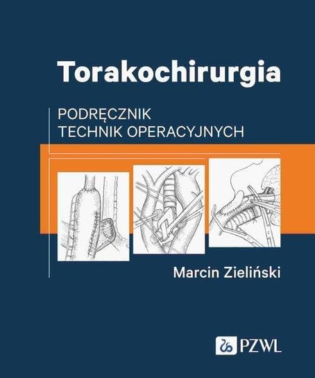 Torakochirurgia. Podręcznik technik operacyjnych Zieliński Marcin