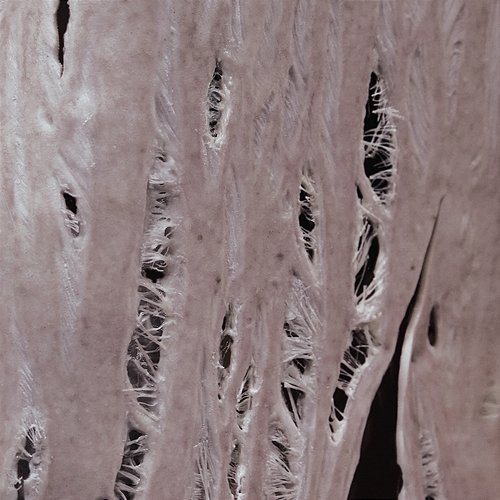 Torn COBRAH