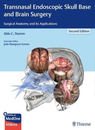 Transnasal Endoscopic Skull Base and Brain Surgery Aldo C. Stamm