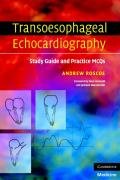 Transoesophageal Echocardiography: Study Guide and Practice Questions Roscoe Andrew