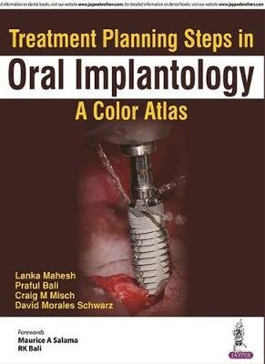 Treatment Planning Steps in Oral Implantology: A Color Atlas Mahesh Lanka