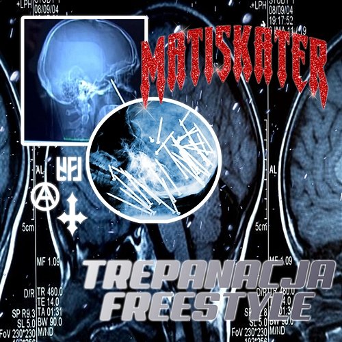 TREPANACJA FREESTYLE matiskater