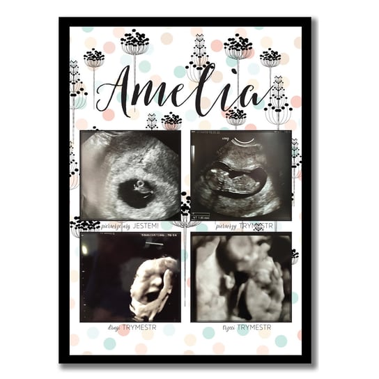 Trymestry ciąży, zdjęcia z USG, pamiątka z ciąży, plakat, Sowia Aleja Inna marka