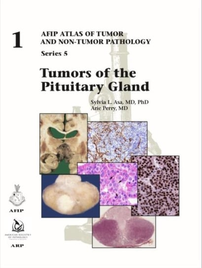 Tumors of the Pituitary Gland Sylvia L. Asa, Arie Perry