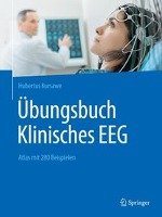Übungsbuch Klinisches EEG Kursawe Hubertus