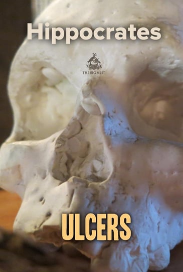 Ulcers Hippocrates