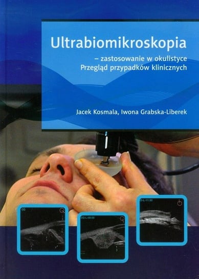 Ultrabiomikroskopia - zastosowanie w okulistyce. Przegląd przypadków klinicznych Kosmala Jacek, Grabska-Liberek Iwona