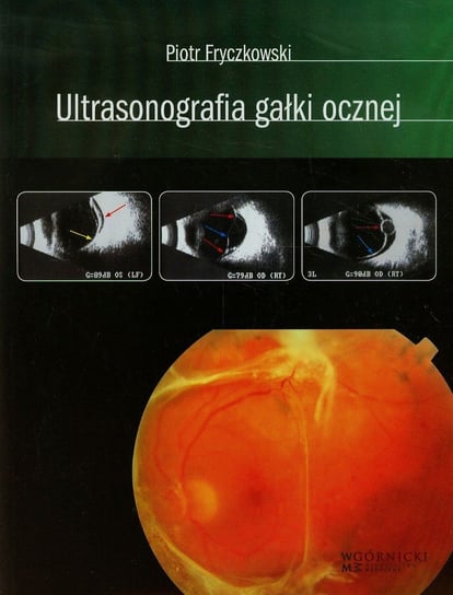 Ultrasonografia gałki ocznej Fryczkowski Piotr