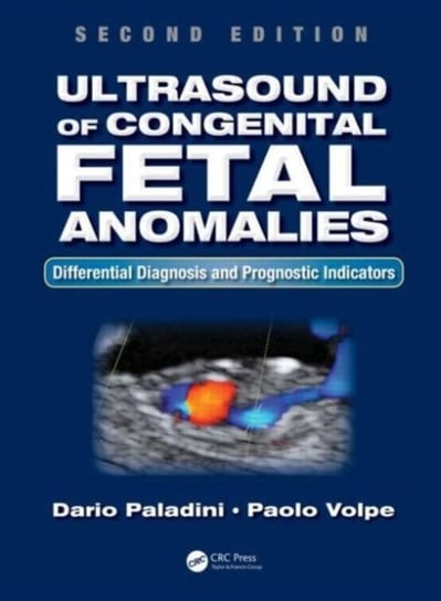 Ultrasound of Congenital Fetal Anomalies Paladini Dario, Volpe Paolo