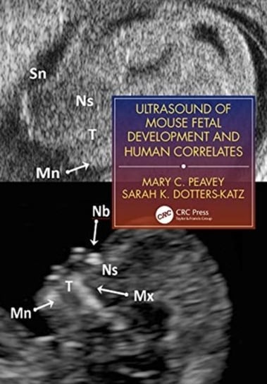 Ultrasound of Mouse Fetal Development and Human Correlates Mary C. Peavey, Sarah K. Dotters-Katz