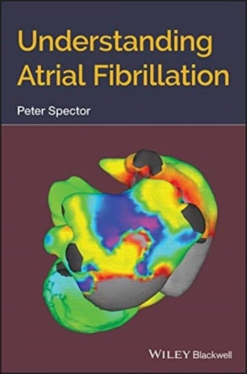 Understanding Atrial Fibrillation Peter Spector