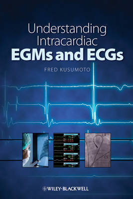 Understanding Intracardiac EGMs and ECGs Kusumoto Fred M.