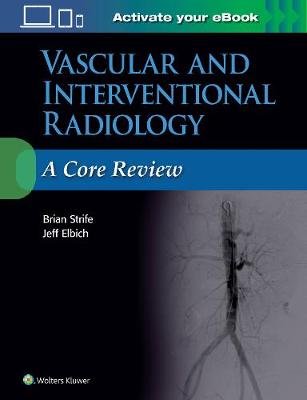 Vascular and Interventional Radiology: A Core Review Strife Brian, Elbich Jeffrey