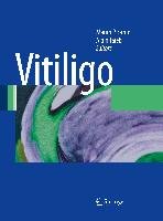 Vitiligo Springer Berlin Heidelberg, Springer Berlin