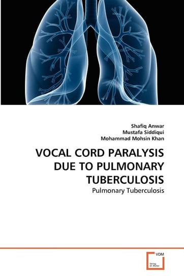Vocal Cord Paralysis Due To Pulmonary Tuberculosis Anwar Shafiq