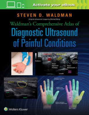 Waldman's Comprehensive Atlas of Diagnostic Ultrasound of Painful Conditions Waldman Steven D.